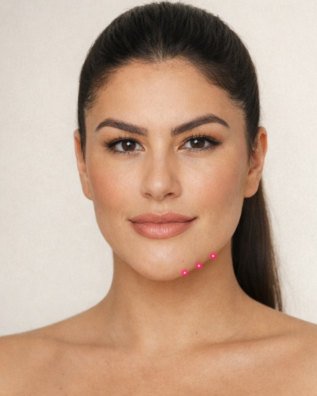 Preenchimento Pré-Jowls